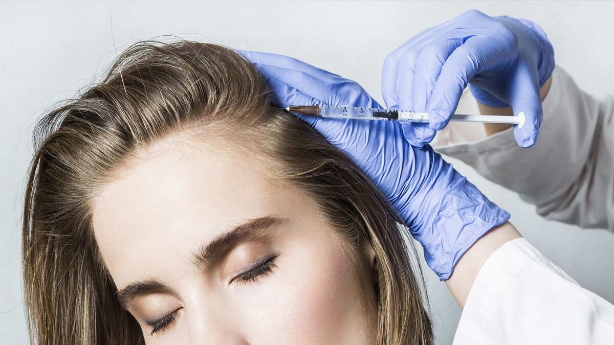 Homeopathy for hair loss treatment